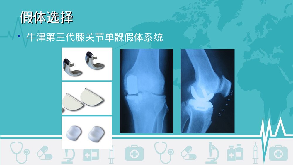 膝关节单髁置换术治疗内侧间室骨性关节炎PPT课件8