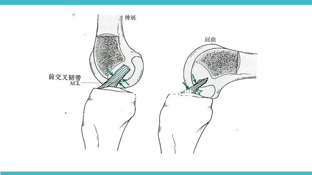 膝关节骨性关节炎非手术治疗PPT课件(带内容·共68页)9
