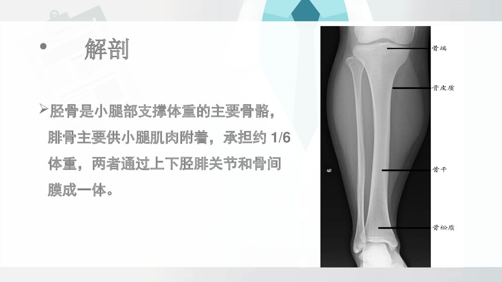 胫腓骨骨折病人围手术期的护理查房PPT课件(带内容·共19页)3