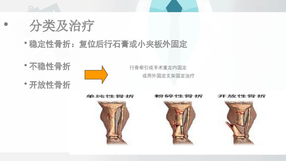 胫腓骨骨折病人围手术期的护理查房PPT课件(带内容·共19页)9