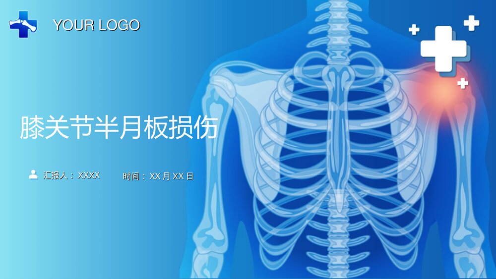 膝关节半月板损伤PPT课件(带内容·共68页)1