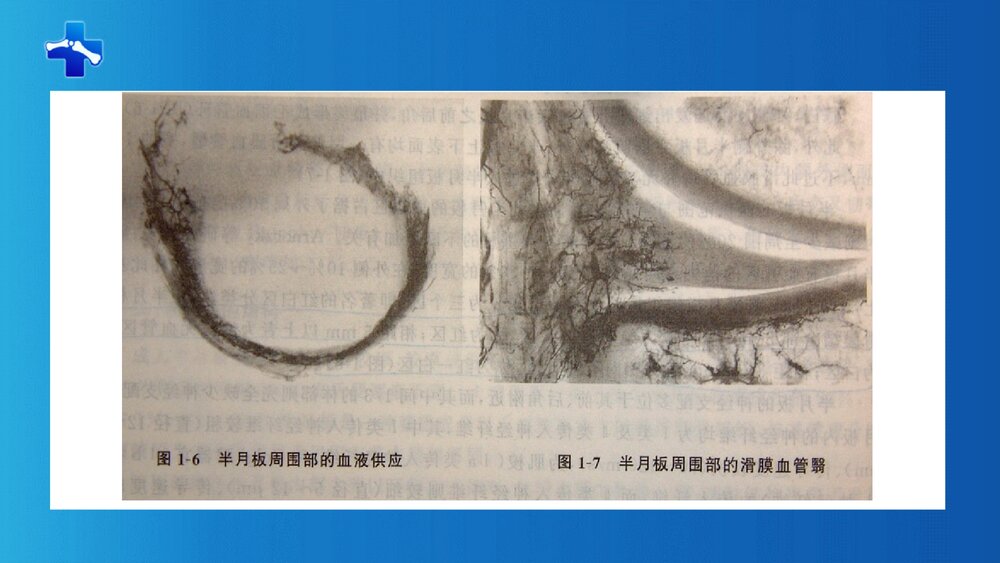 膝关节半月板损伤PPT课件(带内容·共68页)10