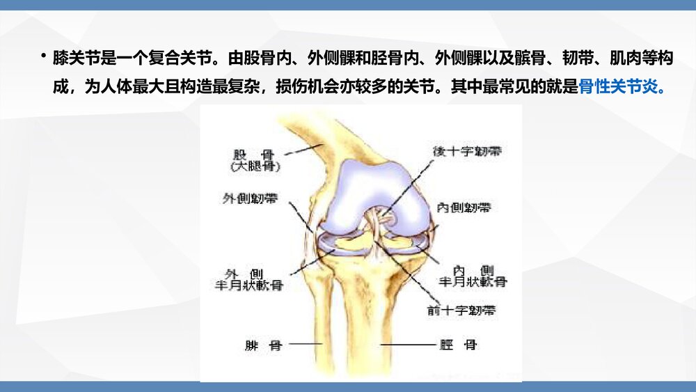人工膝关节置换术手术配合PPT课件(带内容·共36页)3