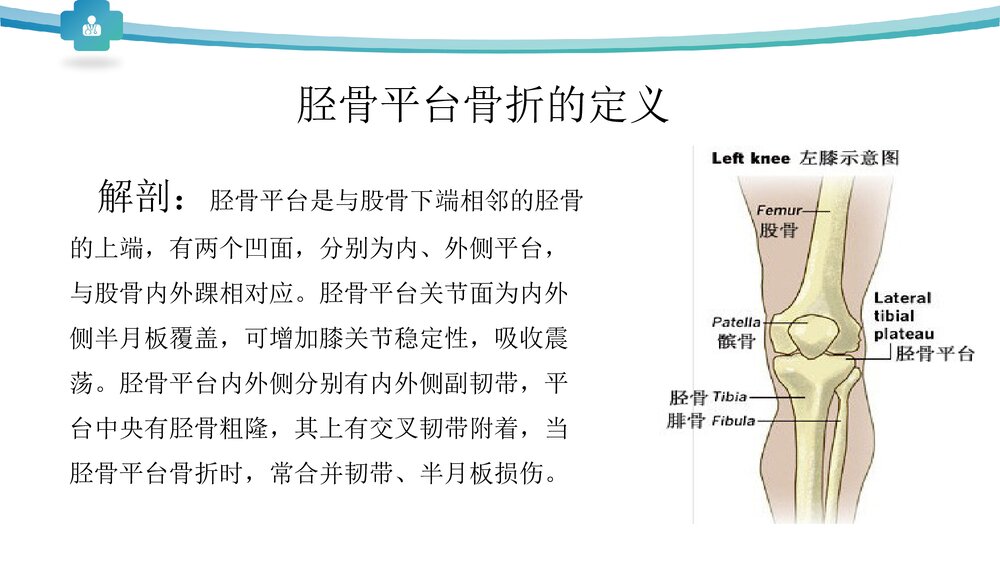 胫骨平台骨折分型治疗PPT课件3