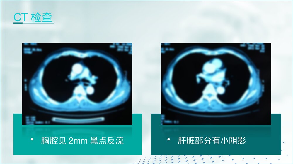 手术病例病理分析汇报PPT课件10