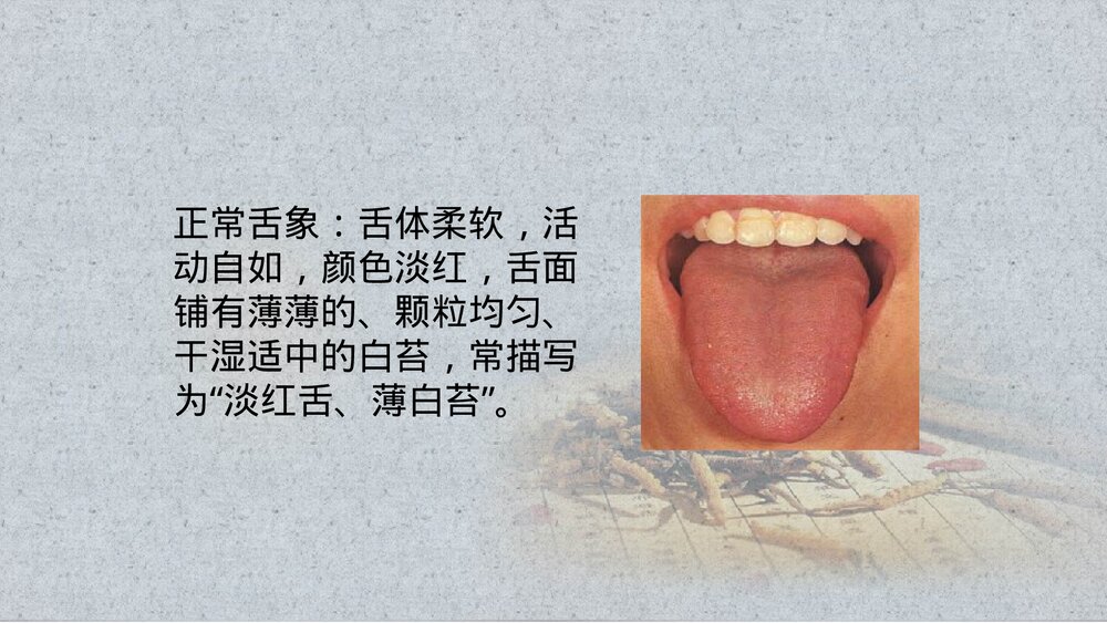 中医舌诊PPT课件(带内容)7