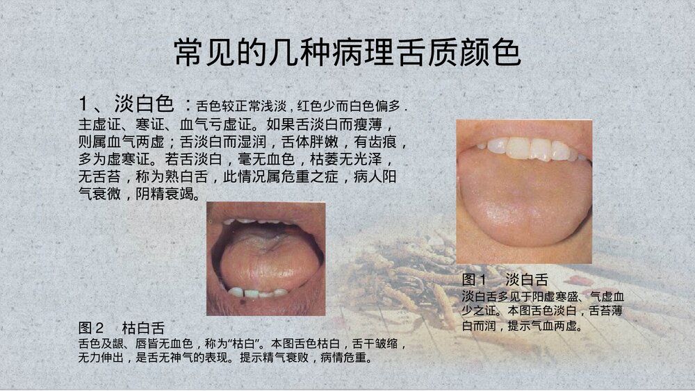 中医舌诊PPT课件(带内容)8