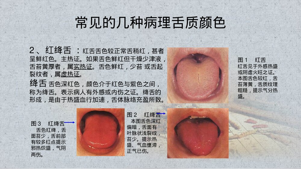 中医舌诊PPT课件(带内容)9