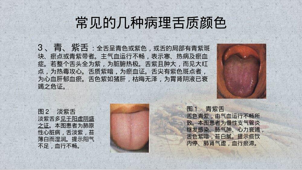 中医舌诊PPT课件(带内容)10
