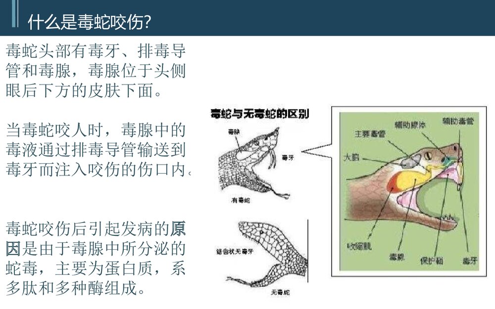 蛇咬伤PBL护理教学查房PPT课件(带内容)8