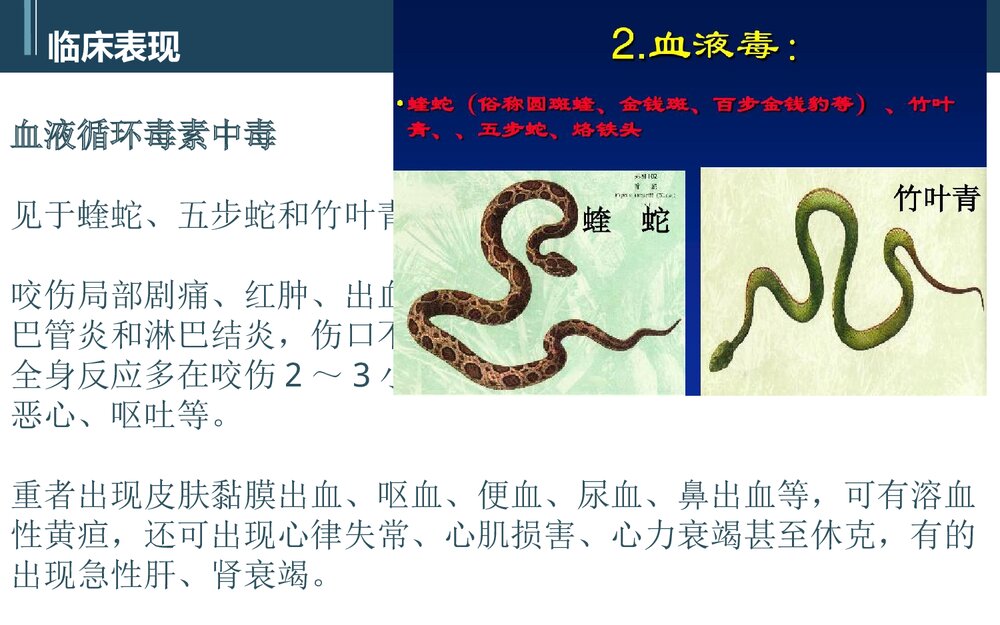 蛇咬伤PBL护理教学查房PPT课件(带内容)10