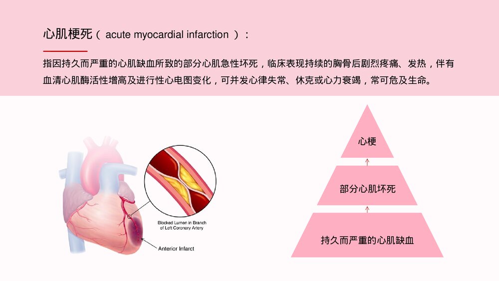 急性心梗护理查房及案例分析PPT课件(带内容)4