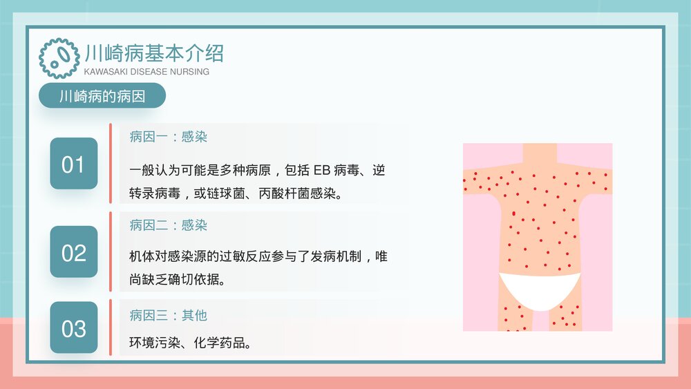 儿科川崎病护理查房完整案例分析PPT课件(带内容)5