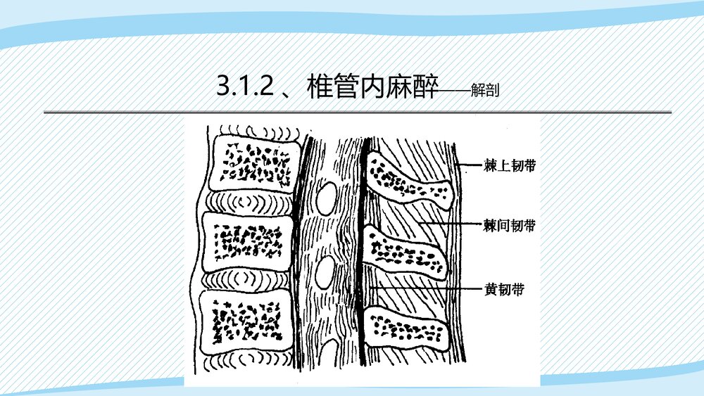 医疗教学课件之·椎管内麻醉PPT课件(带内容)4