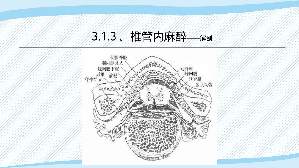 医疗教学课件之·椎管内麻醉PPT课件(带内容)5