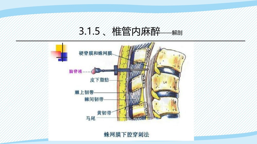 医疗教学课件之·椎管内麻醉PPT课件(带内容)7