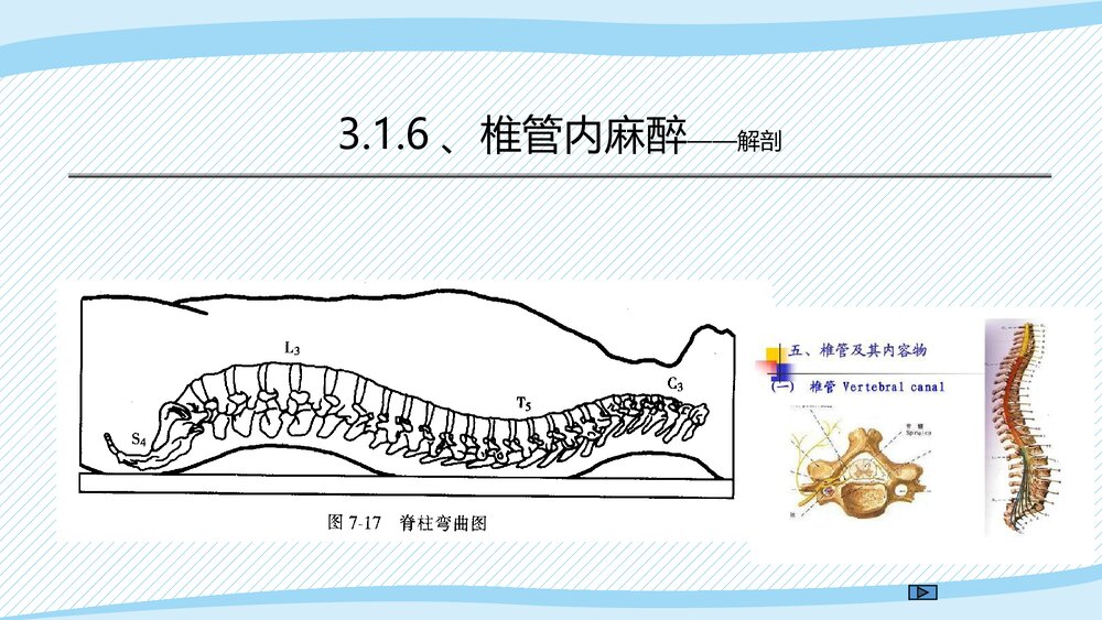 医疗教学课件之·椎管内麻醉PPT课件(带内容)8