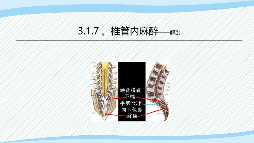 医疗教学课件之·椎管内麻醉PPT课件(带内容)9