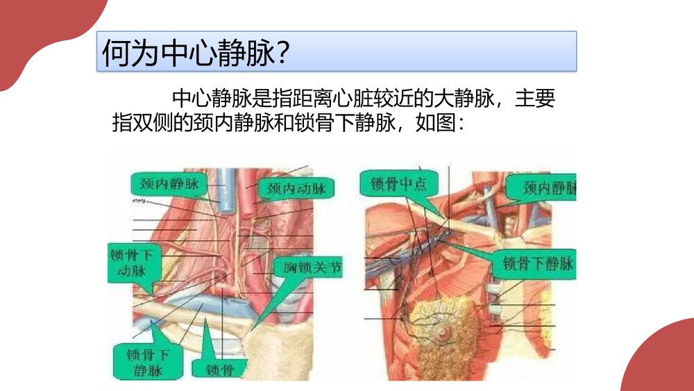 中心静脉穿刺置管感染个案分析PPT课件(共19页·内容可编辑修改)2