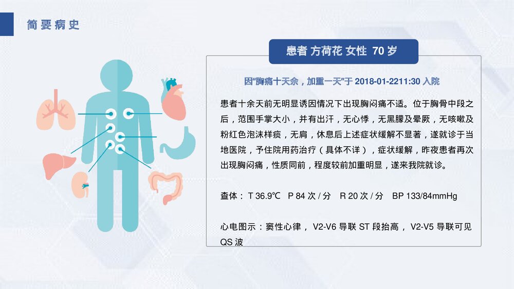 急性心肌梗死护理查房PPT课件(带内容文字·共31页)4
