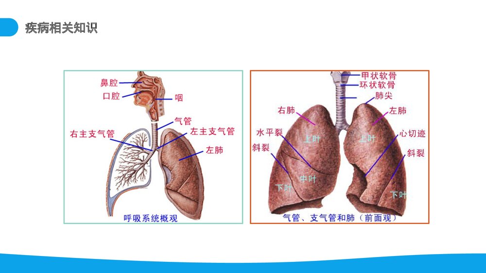 呼吸衰竭病例分析介绍PPT课件(电子版·可编辑修改)8