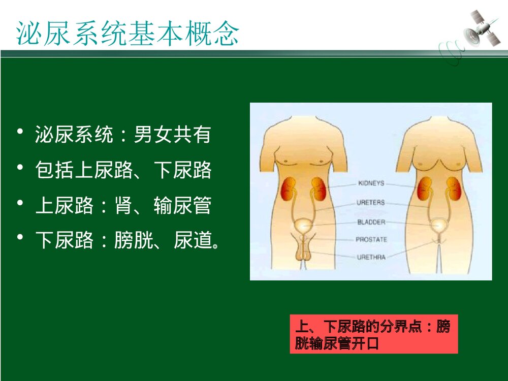 尿源性脓毒血症定义PPT课件(带内容·可编辑修改)2