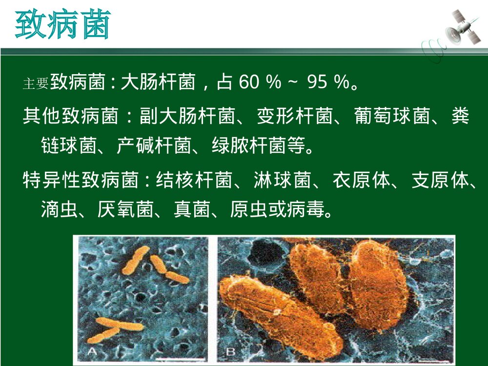 尿源性脓毒血症定义PPT课件(带内容·可编辑修改)7
