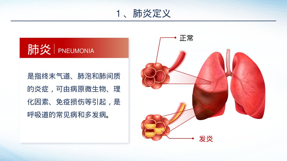 肺炎感染护理培训PPT课件-肺炎护理PPT课件5