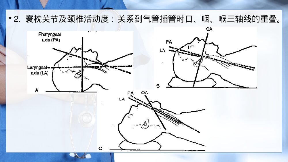 气管内插管术PPT课件(电子版·可编辑修改)7