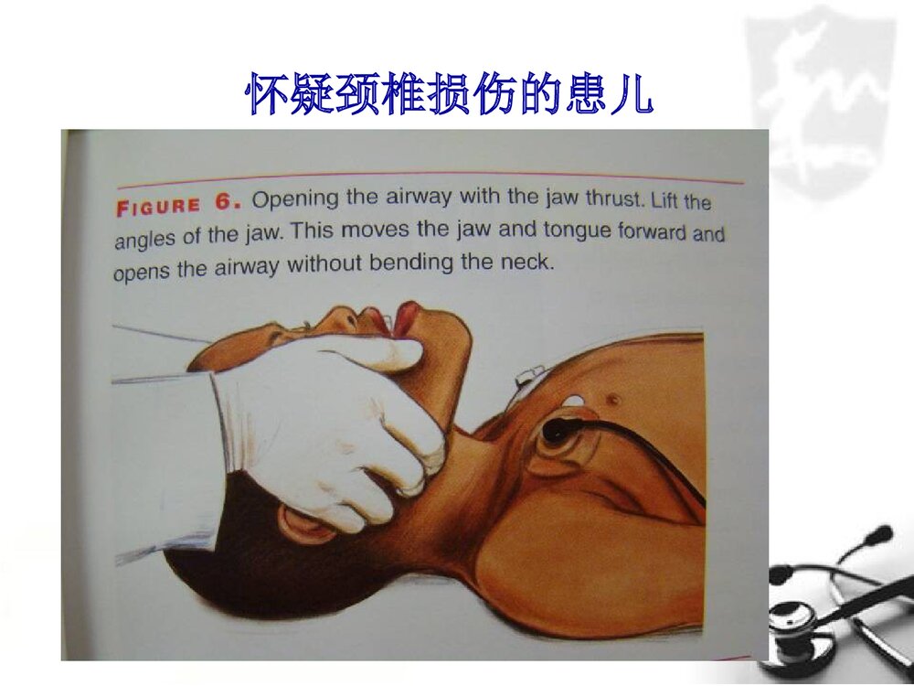 小儿气管插管术PPT课件(带内容文字·图片)4