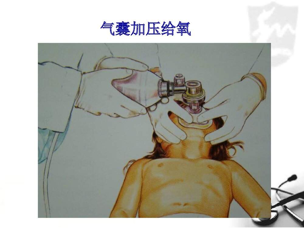 小儿气管插管术PPT课件(带内容文字·图片)9