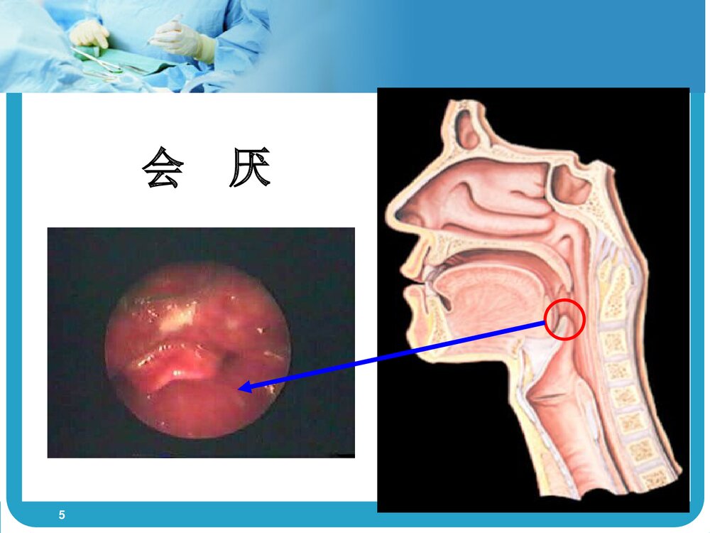气管插管术PPT课件(带内容)5