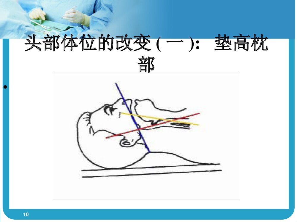 气管插管术PPT课件(带内容)10