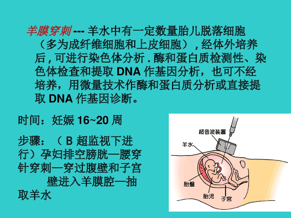 21三体综合征产前诊断PPT课件7