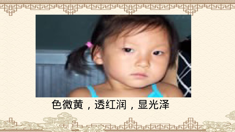 中医儿科·诊法概要PPT课件下载5