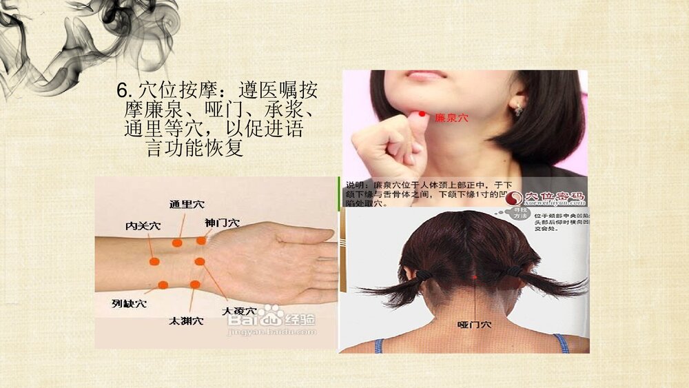 中风(脑梗死恢复期)的中医护理方案PPT课件下载7