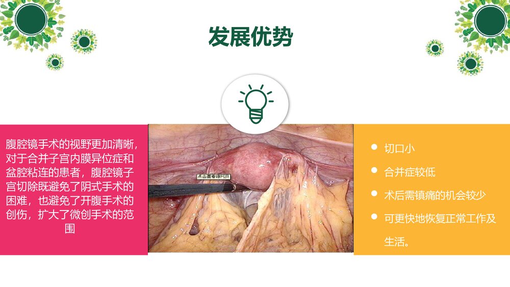 腹腔镜下全宫切--护理查房PPT课件(带内容)3
