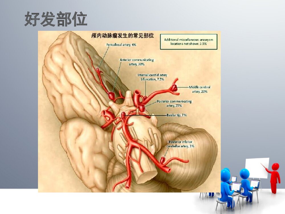脑血管动脉瘤的介入治疗PPT课件5