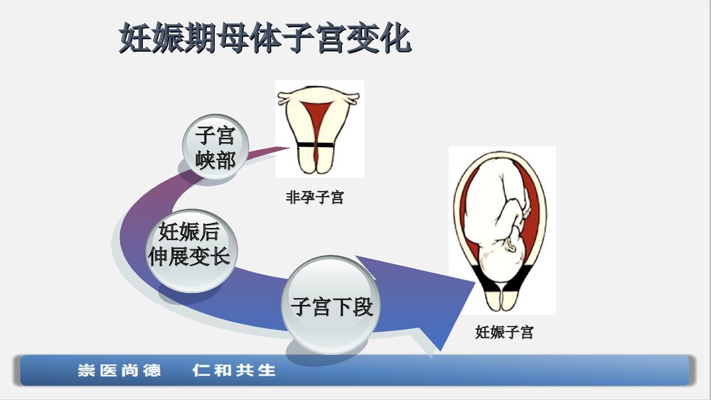 子宫下段剖宫产术手术配合与护理查房ppt课件下载8