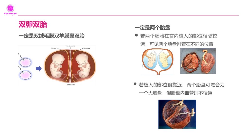 双胎妊娠的产前超声诊断PPT课件9