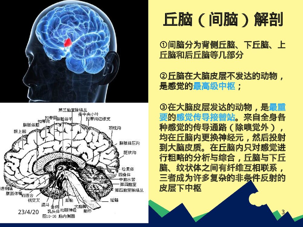 丘脑出血护理PPT课件下载3