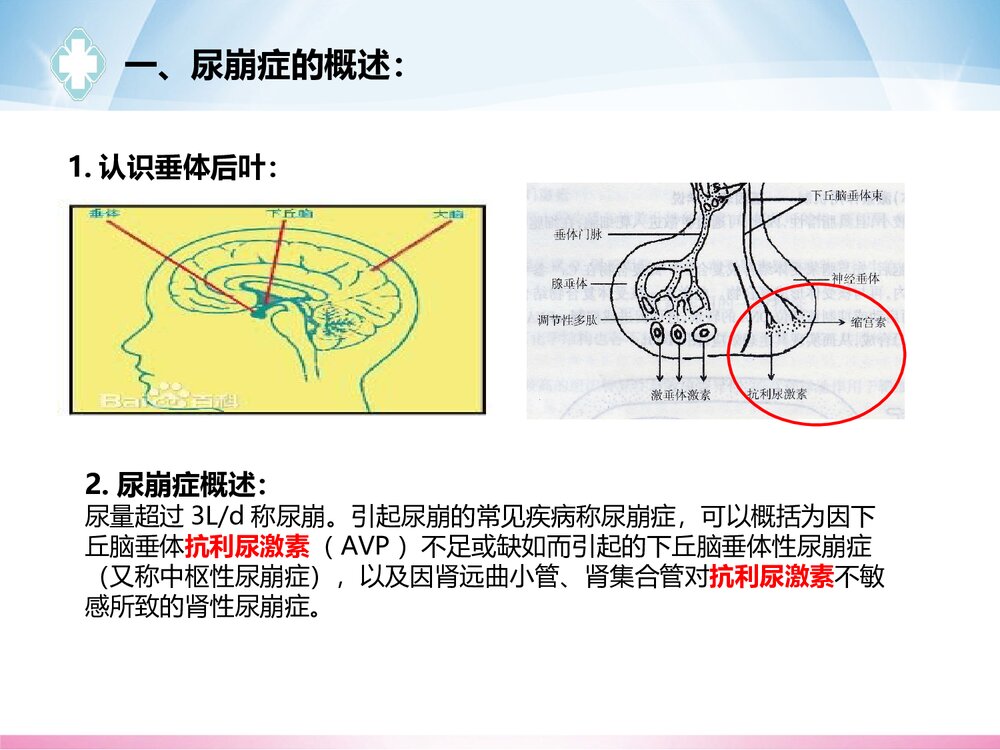 一例尿崩的的护理查房PPT课件(共20页)3