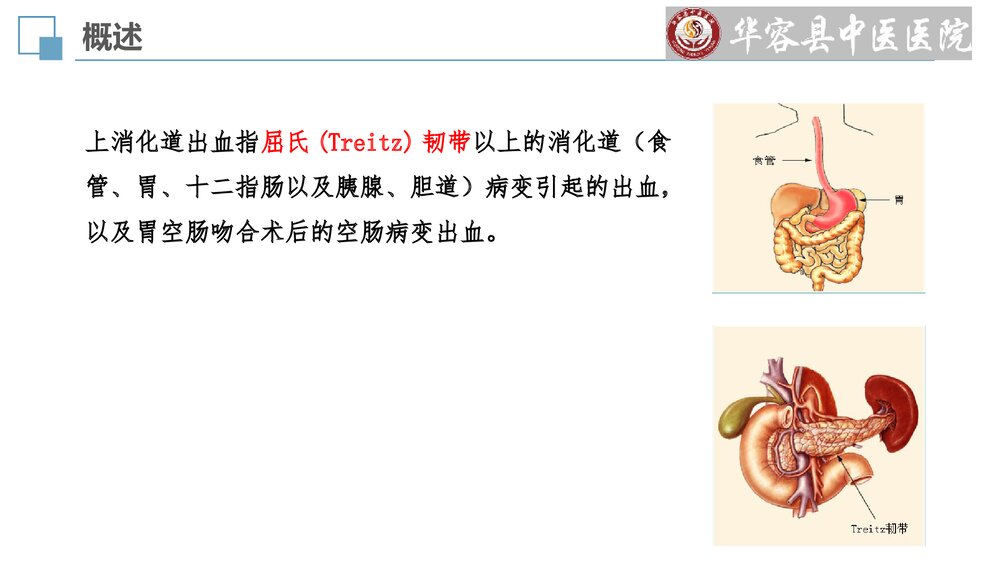 血证(上消化道出血)护理查房PPT课件(共30页)4