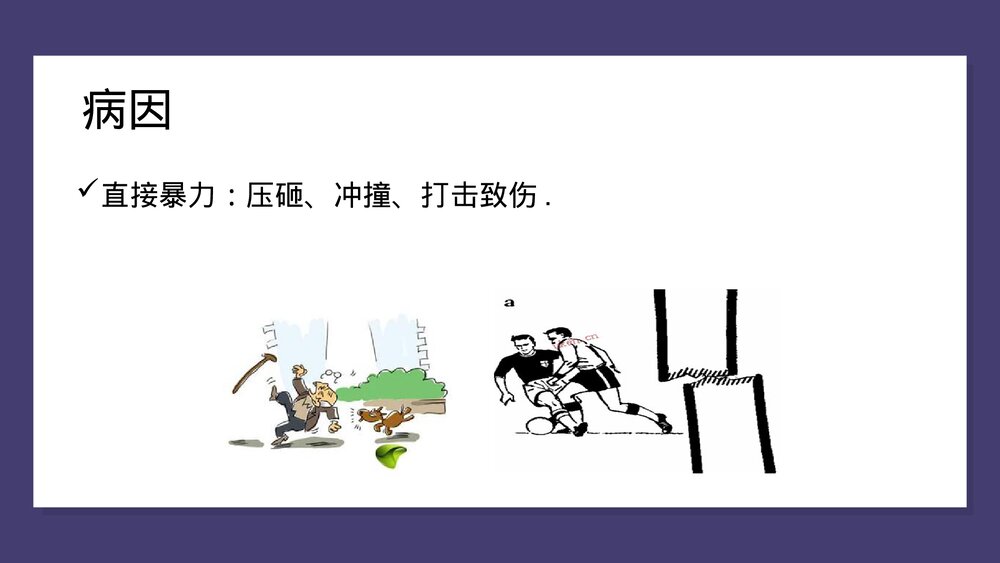 胫腓骨骨折中医护理查房PPT课件(共43页)10
