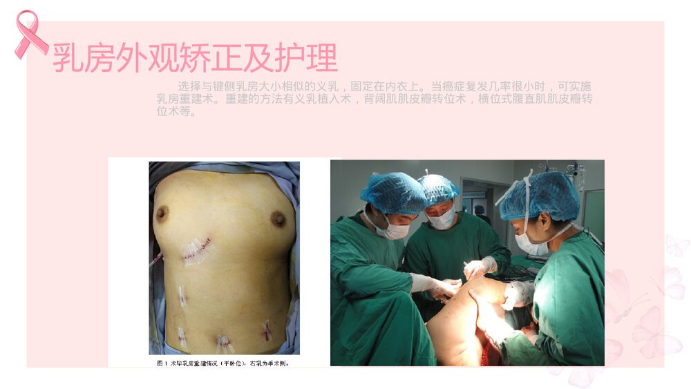 乳腺癌患者术后护理PPT课件下载(共13页)9