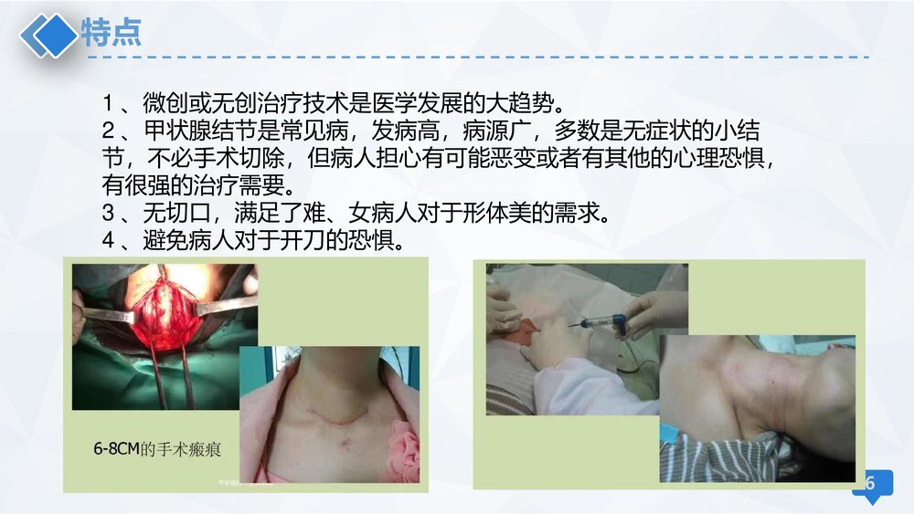 甲状腺微波消融术护理PPT课件下载(共13页·可编辑修改)6
