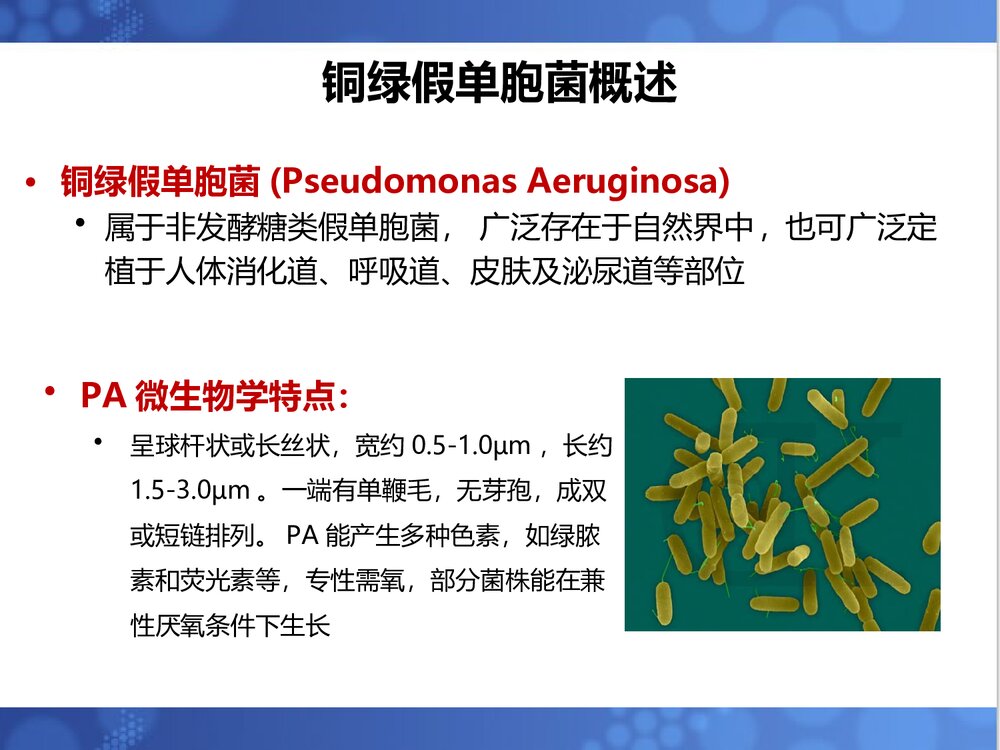 铜绿假单胞菌诊治进展PPT课件下载3