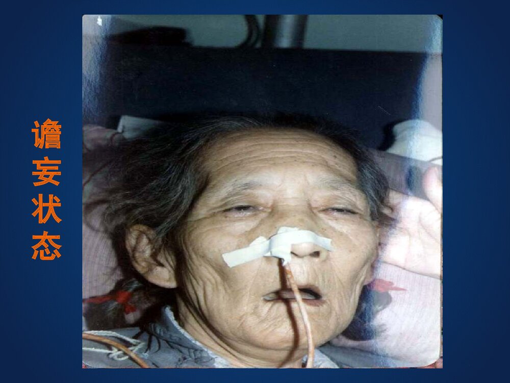 器质性精神障碍患者的护理PPT课件下载7