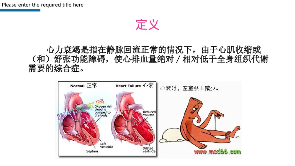 心力衰竭护理查房PPT课件下载3