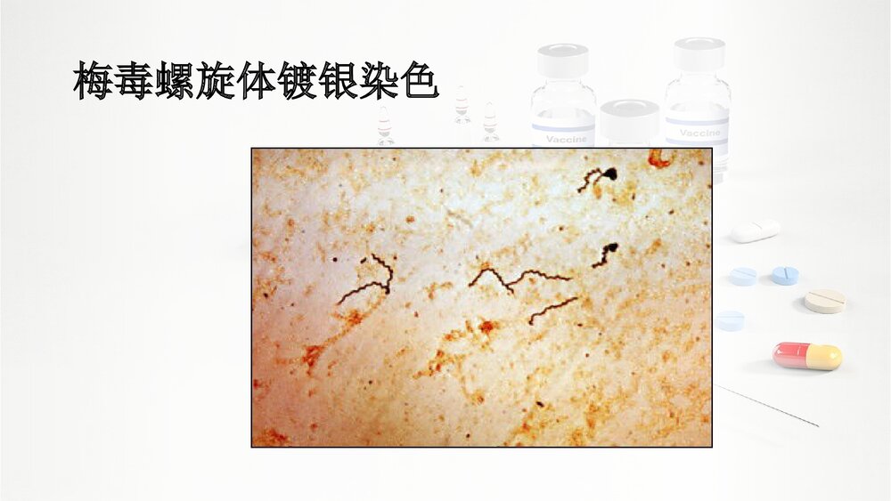 梅毒PPT课件(共37页·可编辑修改)5